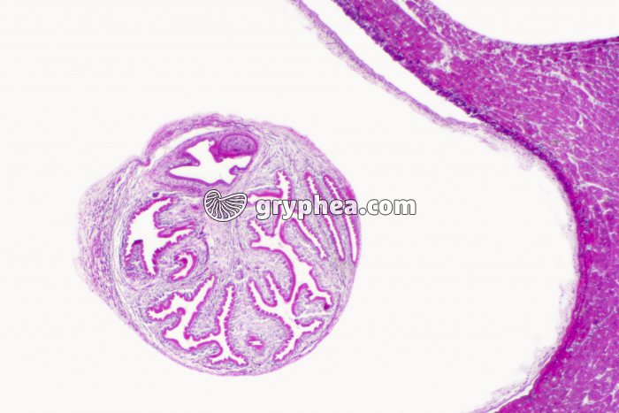 Taenia - ver parasite - Coupe de muscle ladre avec kyste - gryphea.org